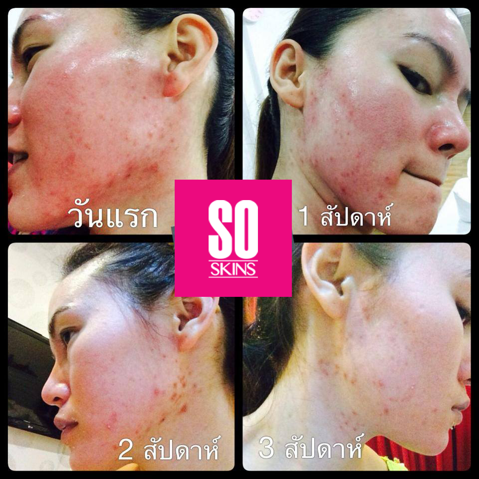 So Skins Sleeping white mask โซ สกิน สลีปปิ้ง มาร์ค 30ML ราชินีแห่งผิวอ่อนเยาว์