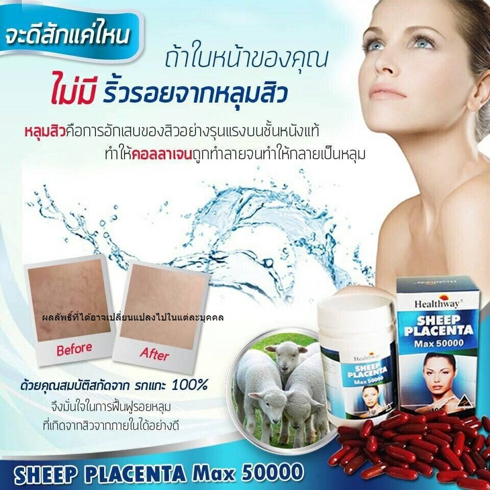 Healthway Sheep Placenta max 50000 เฮลธ์เวย์ ชีป พลาเซนต้า แม็กซ์ 50000(รกแกะ เฮลธ์เวย์)