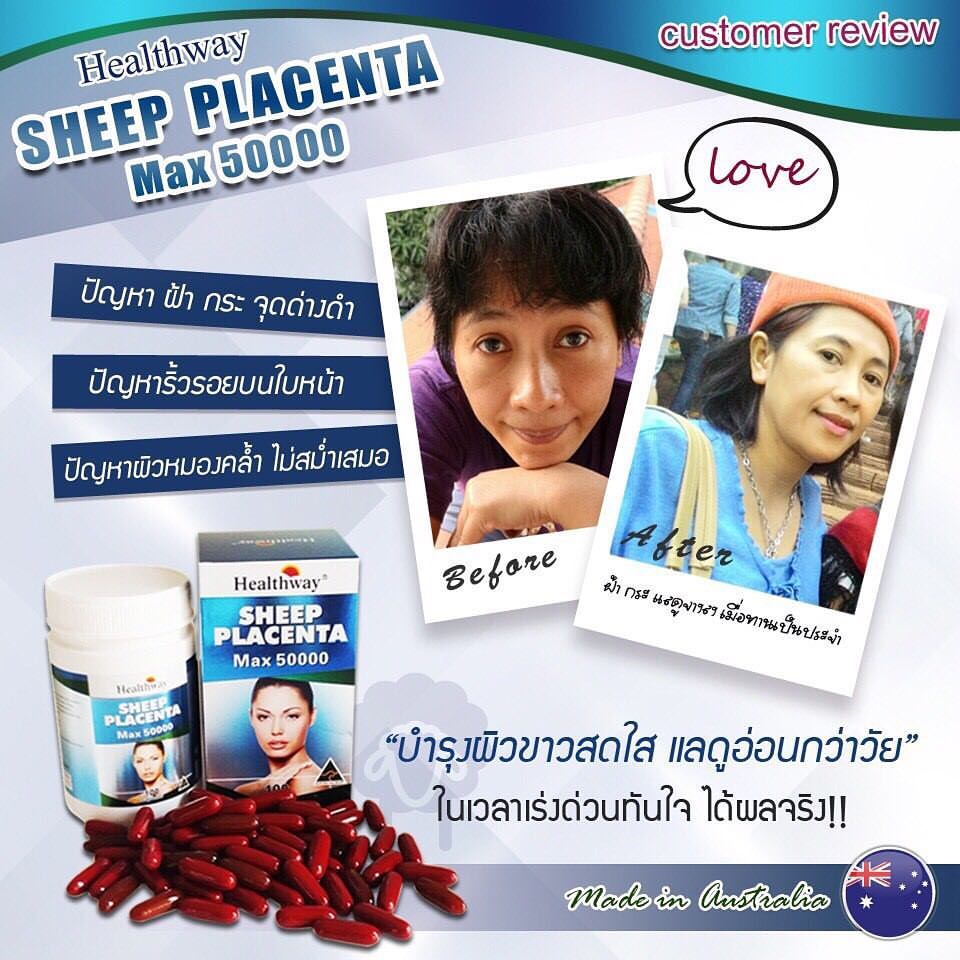 Healthway Sheep Placenta max 50000 เฮลธ์เวย์ ชีป พลาเซนต้า แม็กซ์ 50000(รกแกะ เฮลธ์เวย์)
