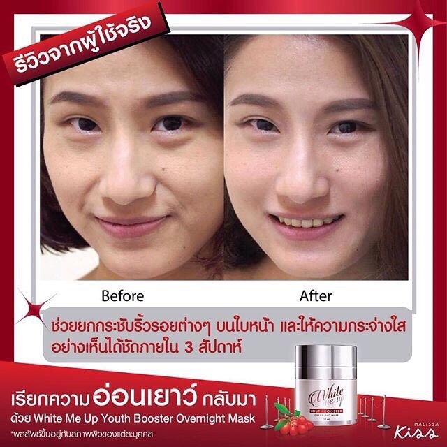Malissa kiss White me Up Youth Booster Over Night Mark