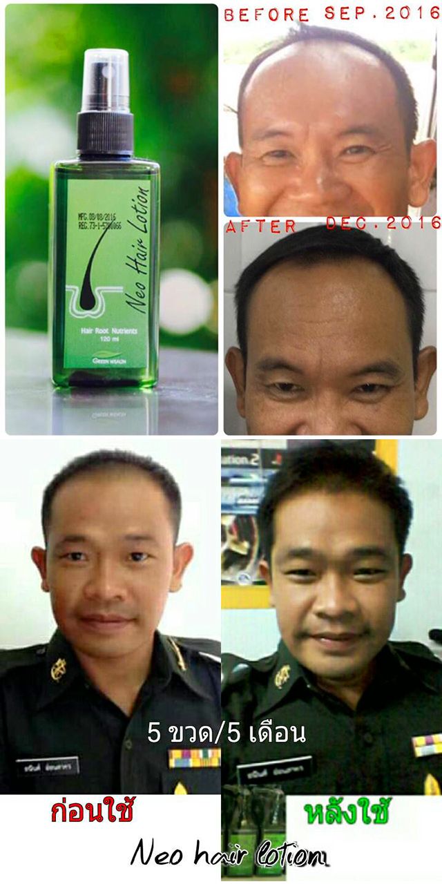 นีโอแฮร์ ส่งฟรี เคอรี่