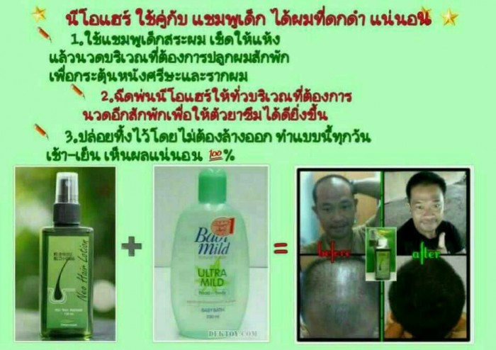 นีโอแฮร์ ส่งฟรี เคอรี่