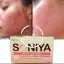 Soniya (โซนิญ่า) อาหารเสริมลดสิว
